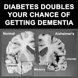 Diabetes doubles the chances of dementia